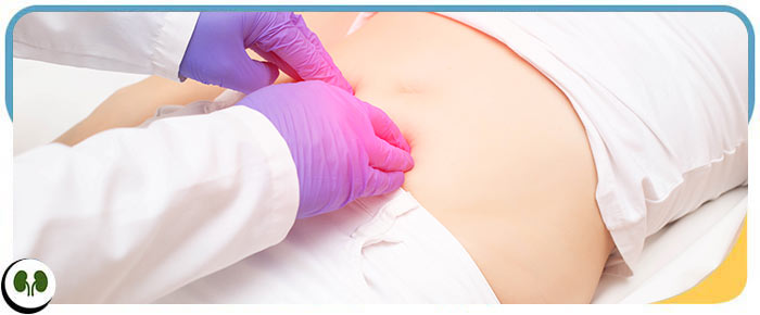 What Are the Methods of Kidney Stone Surgery Near Me in Smithfield NC? What Are the Methods of Kidney Stone Surgery Near Me in Smithfield NC?
